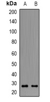 Anti-OLR1 Antibody