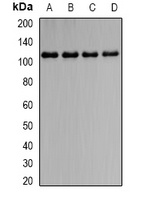 OSMR antibody