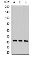 Anti-P2Y1 Antibody