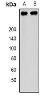 Anti-PCM1 Antibody