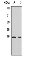 PDCD5 antibody