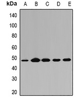 Anti-PGD Antibody