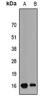 Anti-PLGF Antibody