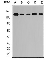 Anti-PITRM1 Antibody