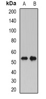 Anti-PLTP Antibody