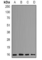 Anti-POLR2D Antibody