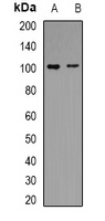 Anti-Periostin Antibody