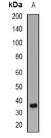 Anti-PPP2CB Antibody