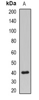 Anti-PPP2R4 Antibody