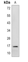 PPP3R2 antibody