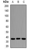 Anti-AMPK beta 2 Antibody