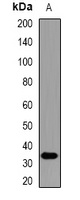 PRKRA antibody