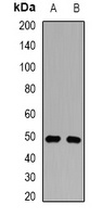 PTPN2 antibody