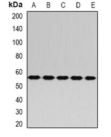 RAB3IP antibody