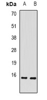 Anti-RBP2 Antibody
