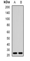 Anti-REEP1 Antibody