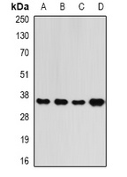 Anti-RFC5 Antibody