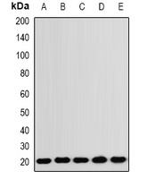 Anti-RNF5 Antibody