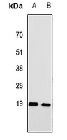 RPA3 antibody