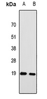 Anti-RPA3 Antibody