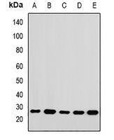 Anti-RPL14 Antibody