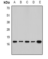 Anti-RPLP1 Antibody