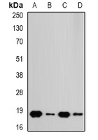 Anti-RPS10 Antibody