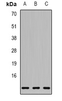 S100A11 antibody