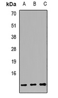 S100A12 antibody