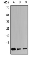 Anti-S100-A4 Antibody
