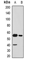 Anti-SFRP4 Antibody