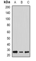 Anti-Sigma1 Receptor Antibody