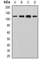 SIK2 antibody