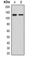 Anti-SIRT1 Antibody