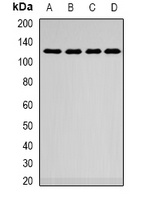 Anti-SMARCAD1 Antibody