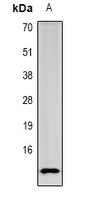 Anti-SPINK1 Antibody