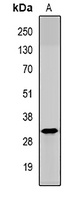 Anti-HAI-2 Antibody