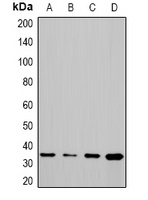 STUB1 antibody