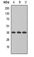 Anti-TAMM41 Antibody