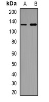Anti-CD30 Antibody