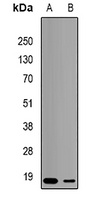 Anti-TNNC2 Antibody