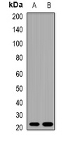 Cystatin C antibody