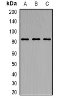 TRPV5 antibody