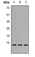 Anti-GILZ Antibody