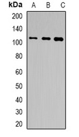 Anti-TSHR Antibody