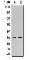 Anti-Thymidine Phosphorylase Antibody
