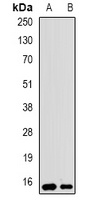 UBE2D1 antibody