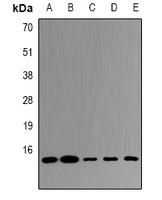 UBE2D4 antibody