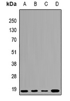 UBE2L3 antibody