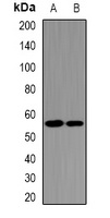 Anti-UGDH Antibody